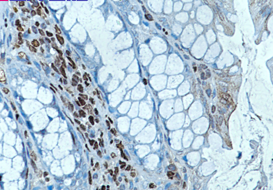 2 - RUNX1/2/3 Rabbit mAb AP76043