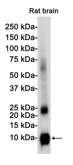 1 - S100 beta Rabbit mAb AP76045