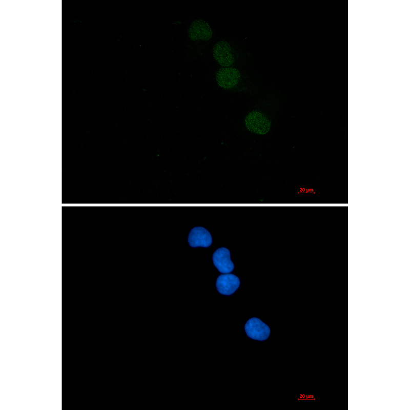 1 - SAE1 Rabbit mAb AP76050