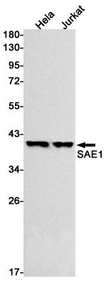 8 - SAE1 Rabbit mAb AP76050