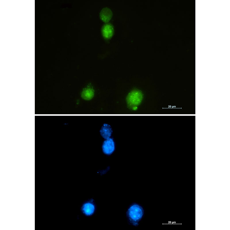 1 - SAFB1 Rabbit mAb AP76051