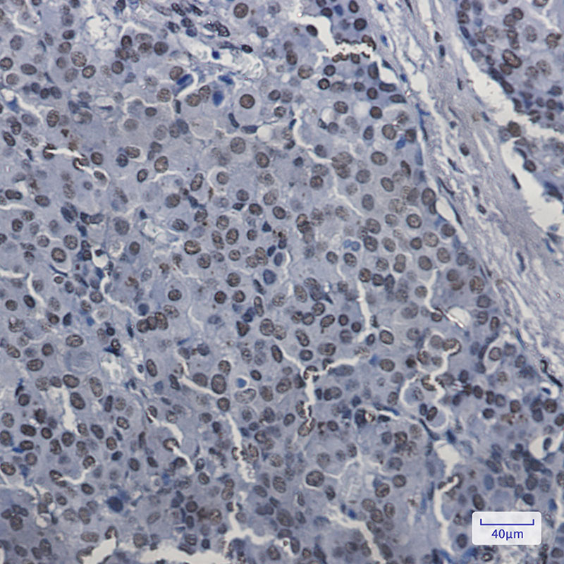 3 - SAFB1 Rabbit mAb AP76051