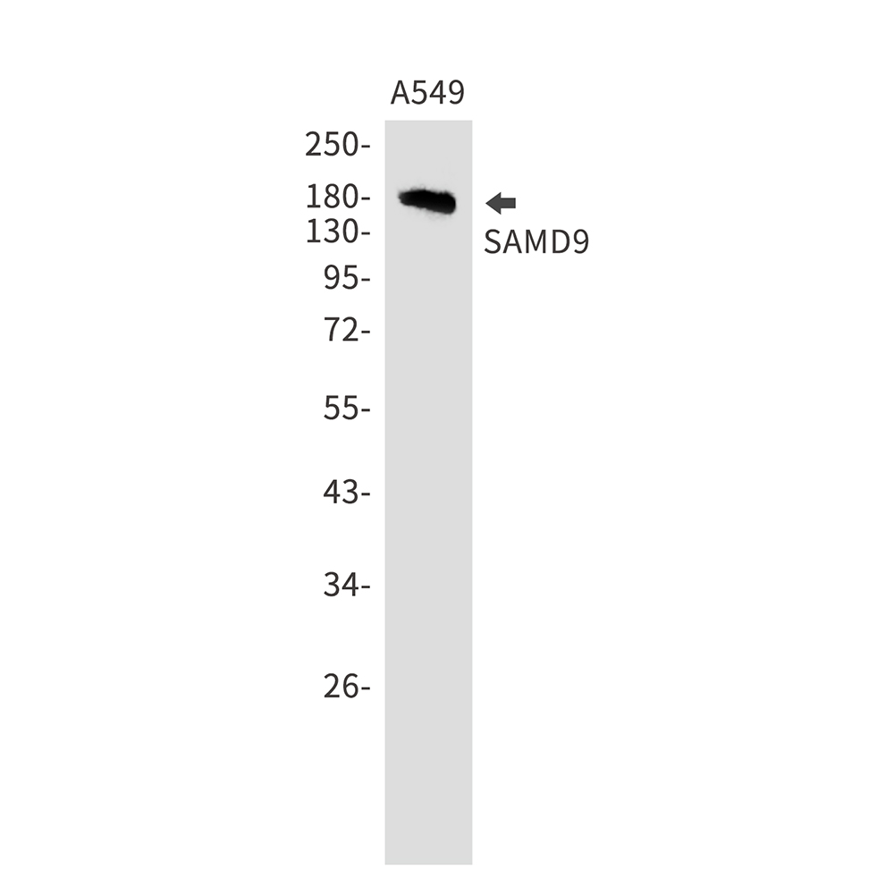1 - SAMD9 Rabbit mAb AP76053