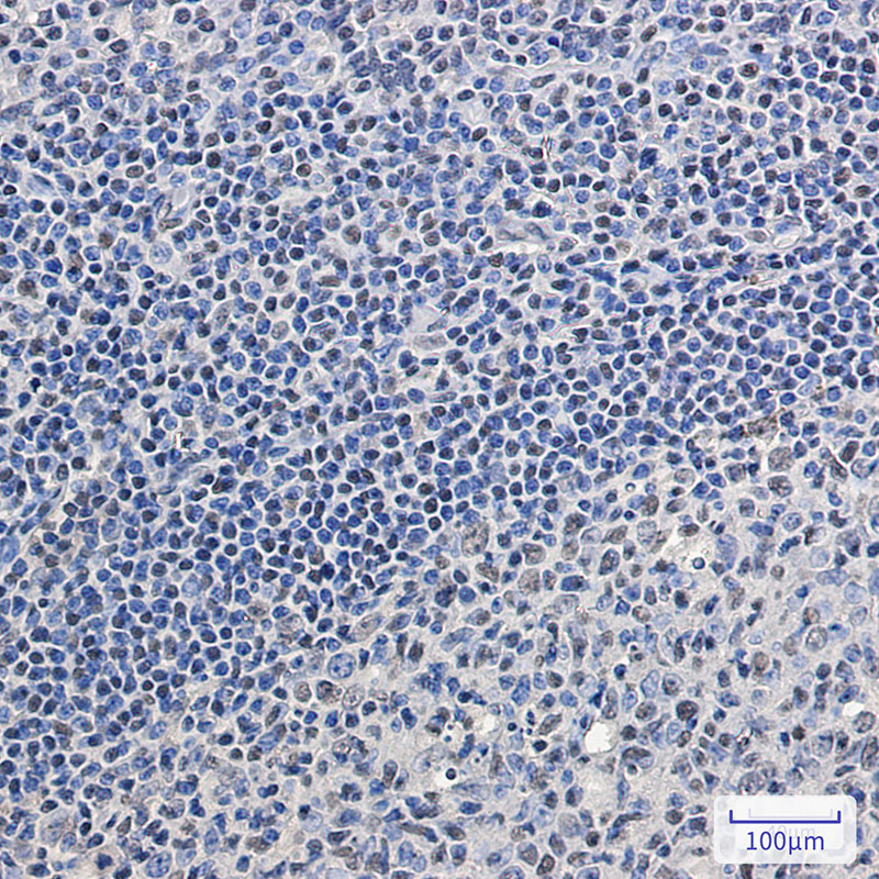 2 - SC35 Rabbit mAb AP76055