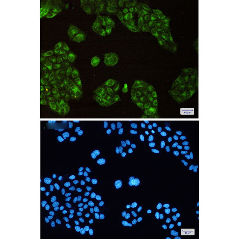 2 - SCD1 Rabbit mAb AP76059