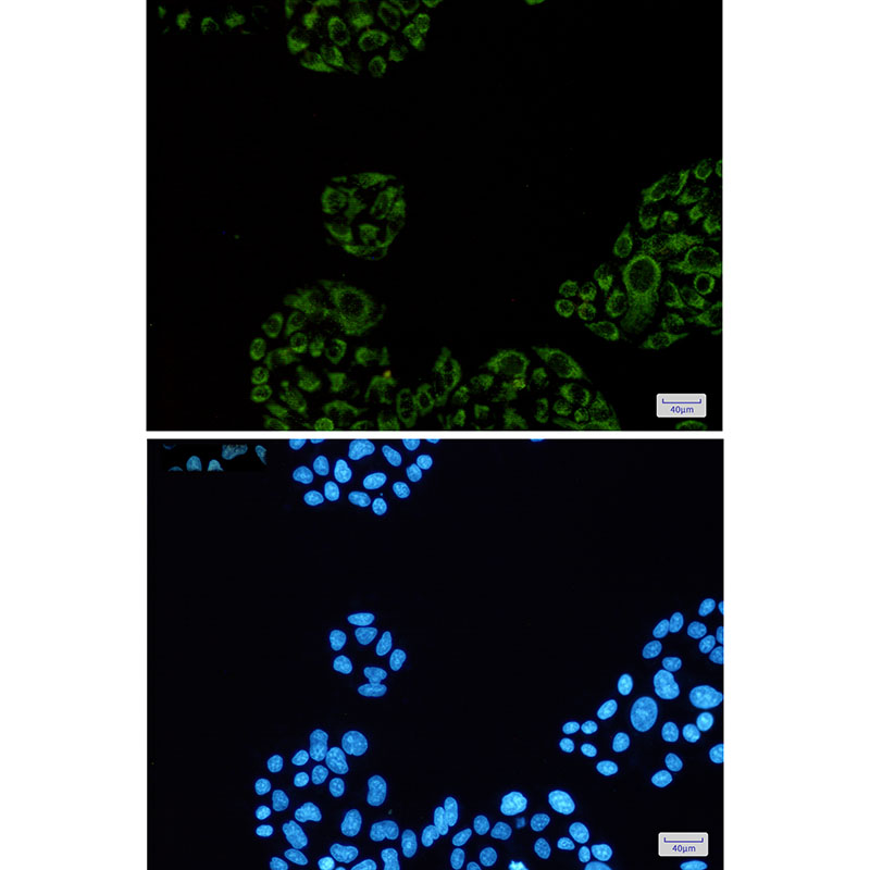 2 - SDHA Rabbit mAb AP76062