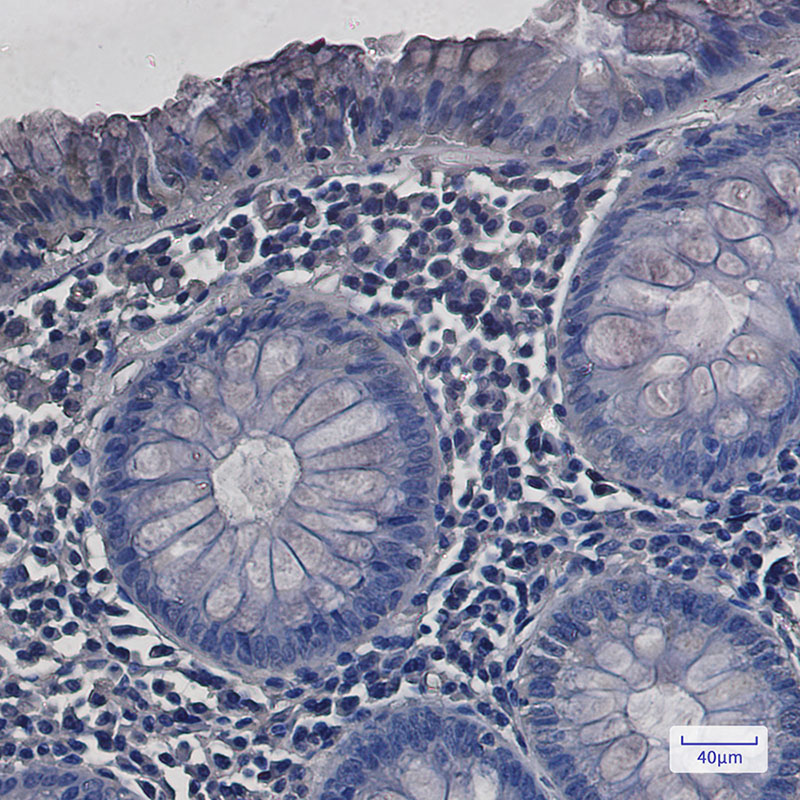 8 - SDHA Rabbit mAb AP76062