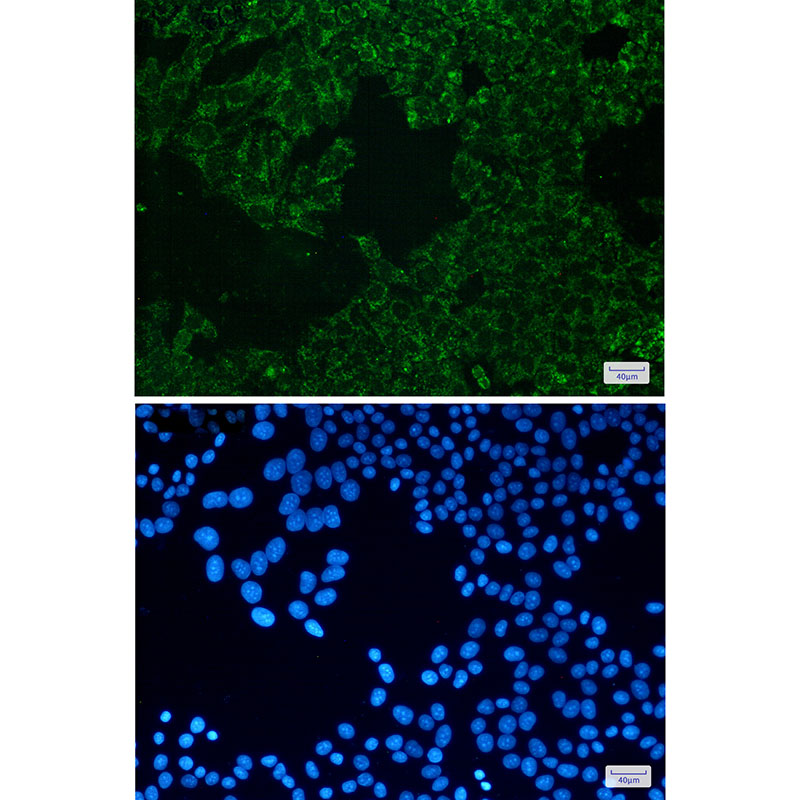 3 - SEC61A Rabbit mAb AP76063