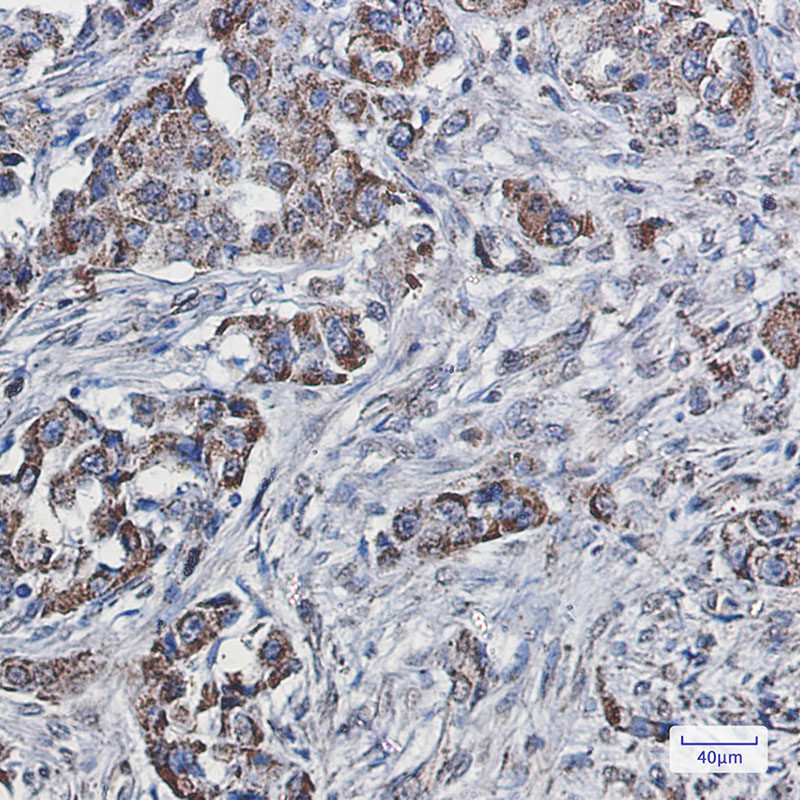 2 - SEC61A Rabbit mAb AP76063