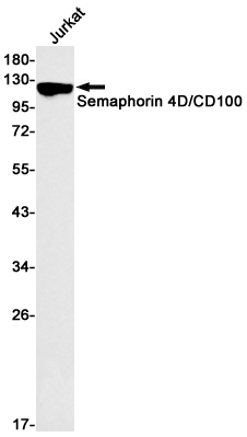 2 - SEMA4D Rabbit mAb AP76067