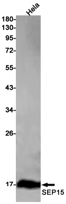 1 - SEP15 Rabbit mAb AP76068