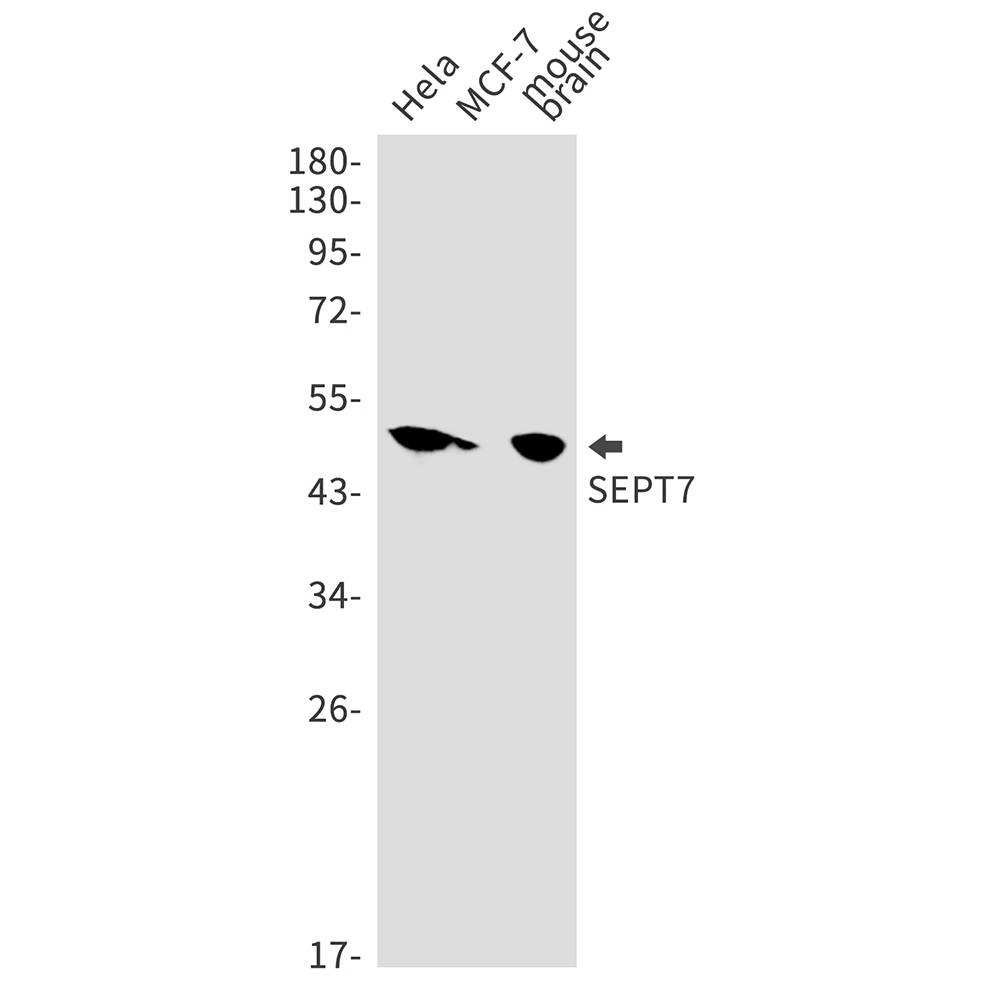 8 - SEPT7 Rabbit mAb AP76069