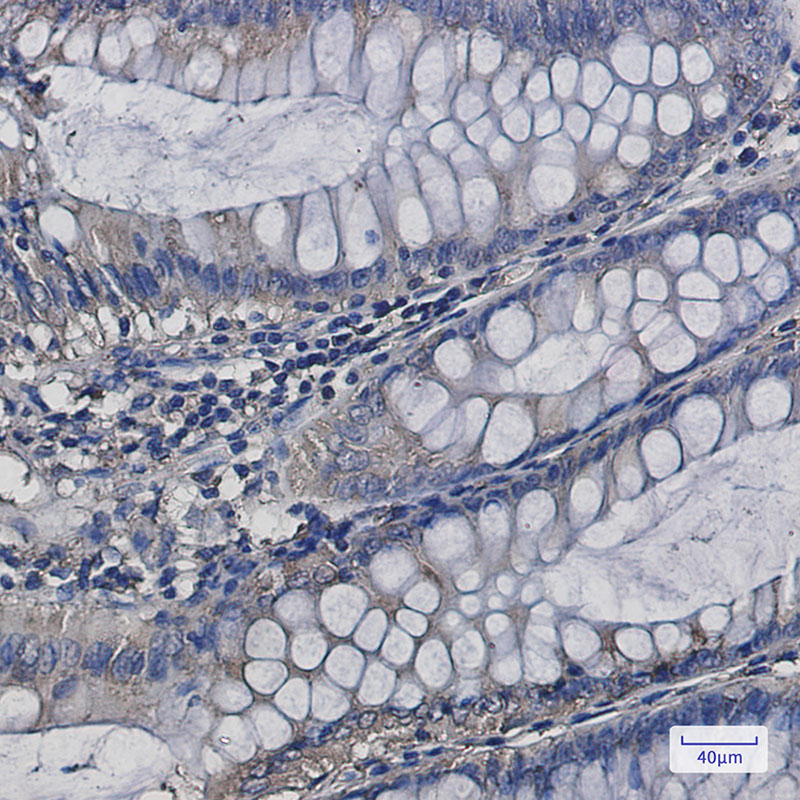 4 - SERCA2 ATPase Rabbit mAb AP76070