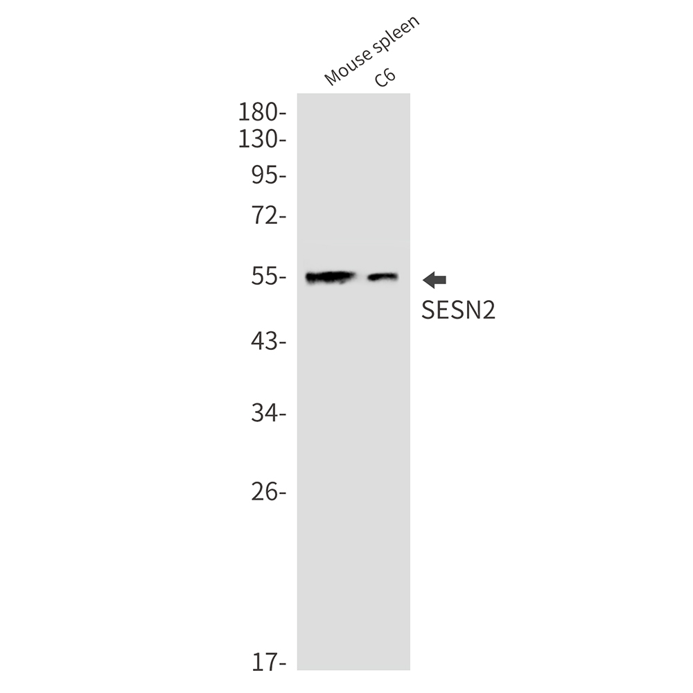 8 - SESN2/Sestrin-2 Rabbit mAb AP76071