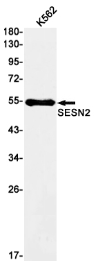 4 - SESN2/Sestrin-2 Rabbit mAb AP76071