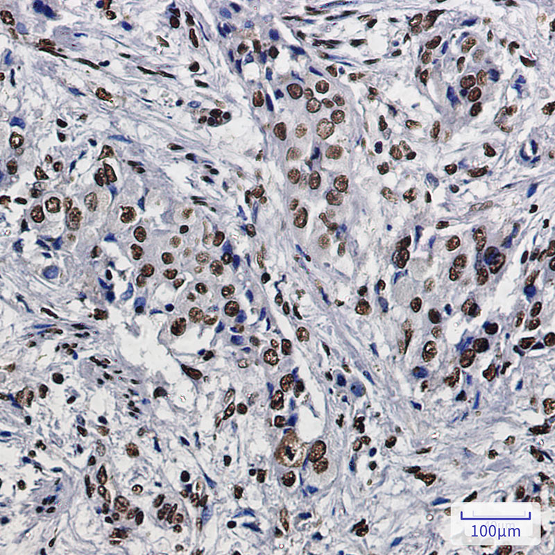 8 - SET Rabbit mAb AP76072