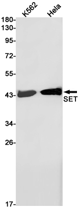 1 - SET Rabbit mAb AP76072