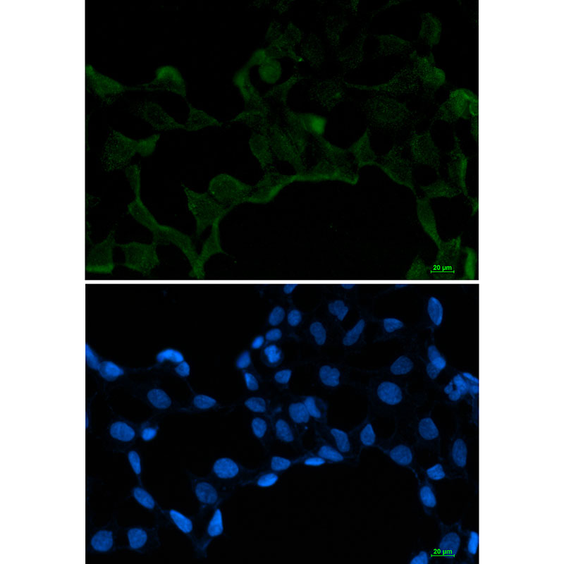 1 - SF2 Rabbit mAb AP76073