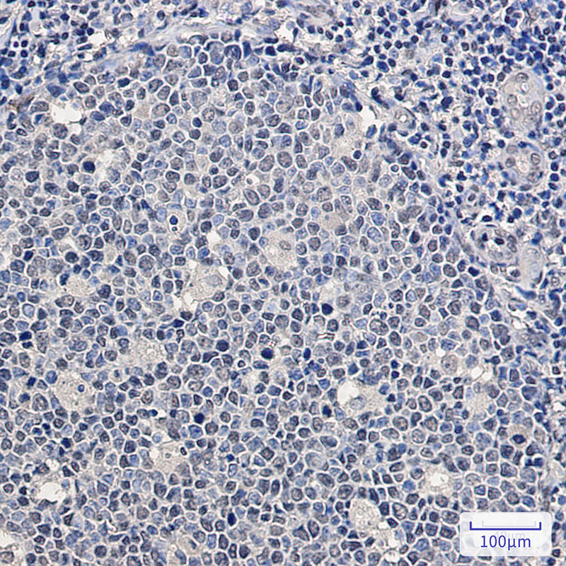 4 - SF2 Rabbit mAb AP76073