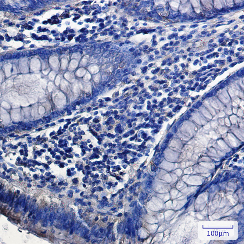 8 - SH3PX1/SNX9 Rabbit mAb AP76079