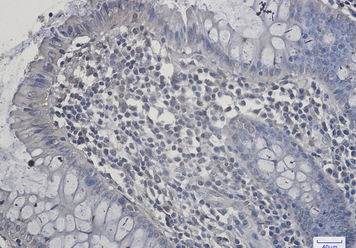 5 - SIRT2 Rabbit mAb AP76085
