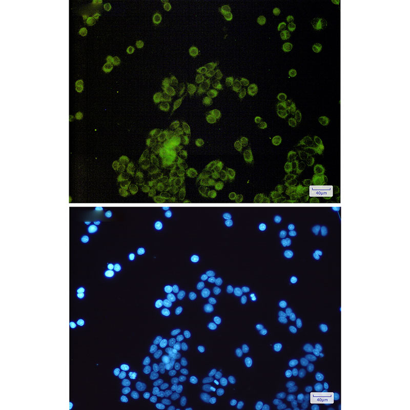 2 - SLC27A4 / FATP4 Rabbit mAb AP76092