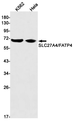 1 - SLC27A4 / FATP4 Rabbit mAb AP76092