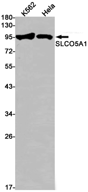 2 - OATP5A1 Rabbit mAb AP76093