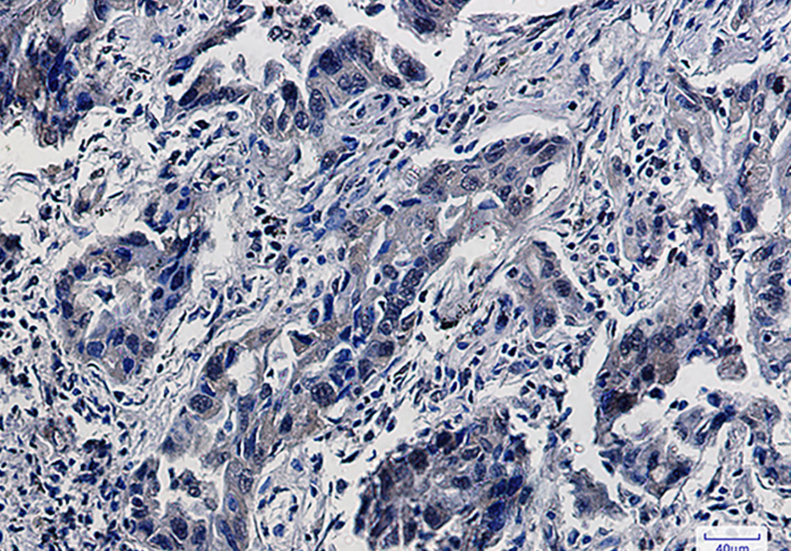 2 - Smad5 Rabbit mAb AP76096