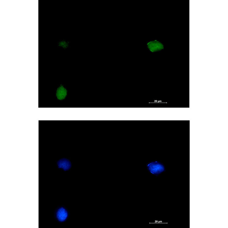 1 - SMARCC1/BAF155 Rabbit mAb AP76097