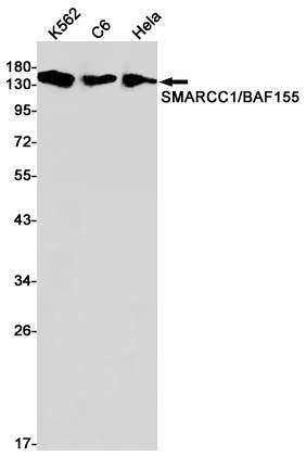 8 - SMARCC1/BAF155 Rabbit mAb AP76097