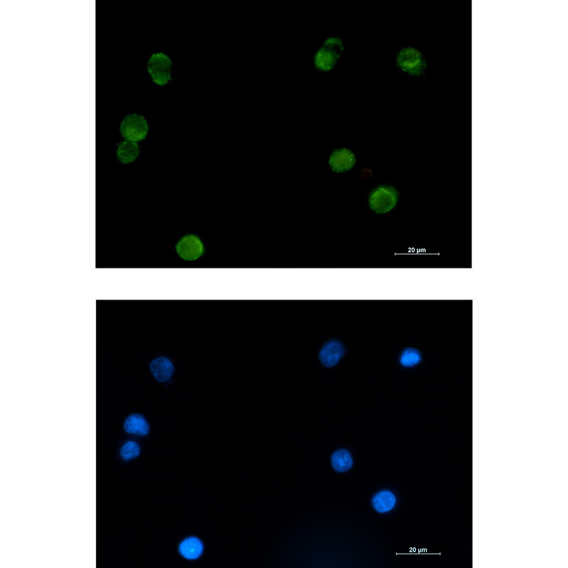 1 - SMYD3 Rabbit mAb AP76099