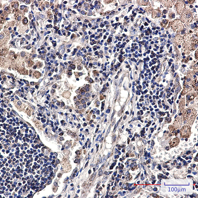 8 - SMYD3 Rabbit mAb AP76099