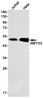 2 - SMYD3 Rabbit mAb AP76099