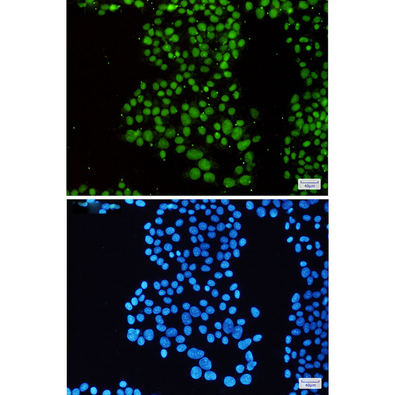 2 - SNF5/SMARCB1 Rabbit mAb AP76103