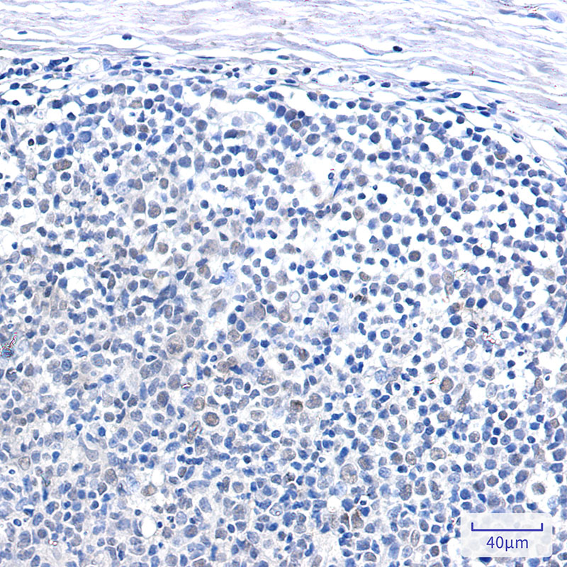 8 - SNF5/SMARCB1 Rabbit mAb AP76103