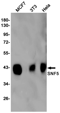 1 - SNF5/SMARCB1 Rabbit mAb AP76103