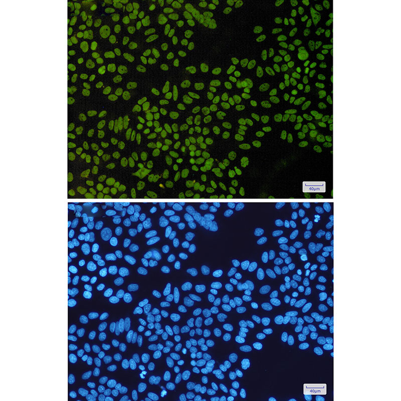 2 - SNF5/SMARCB1 Rabbit mAb AP76104