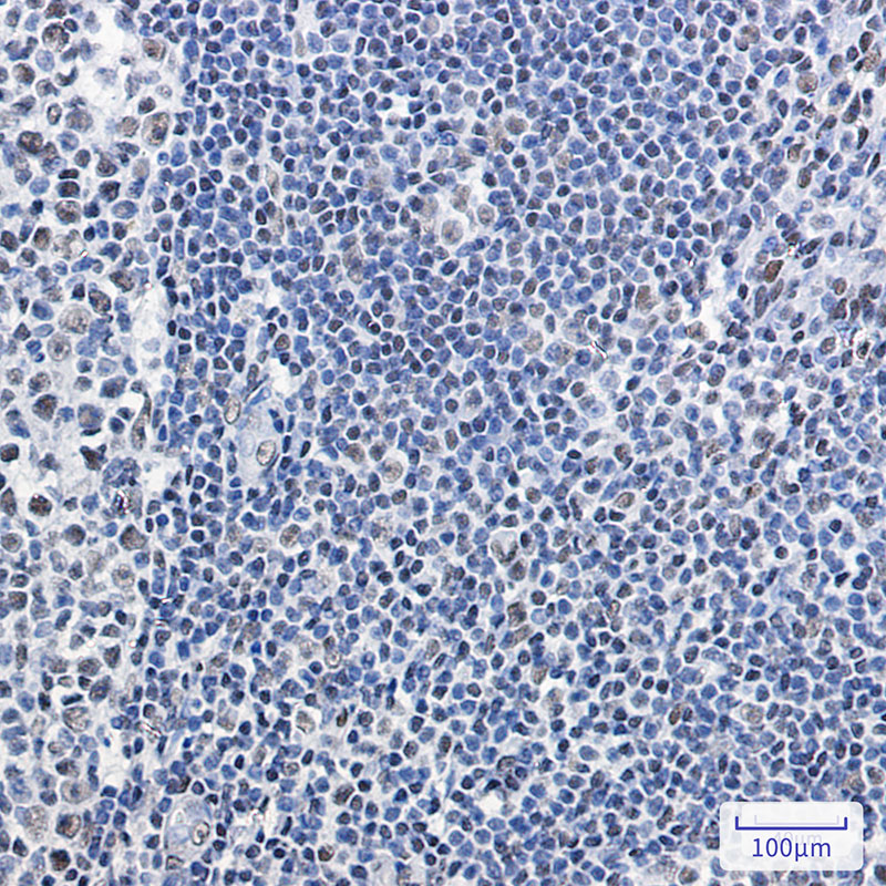 1 - SNF5/SMARCB1 Rabbit mAb AP76104