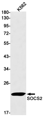 1 - SOCS2 Rabbit mAb AP76107
