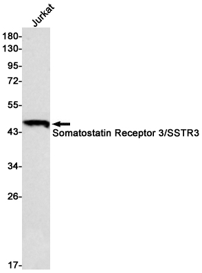 1 - Somatostatin Receptor 3 Rabbit mAb AP76108