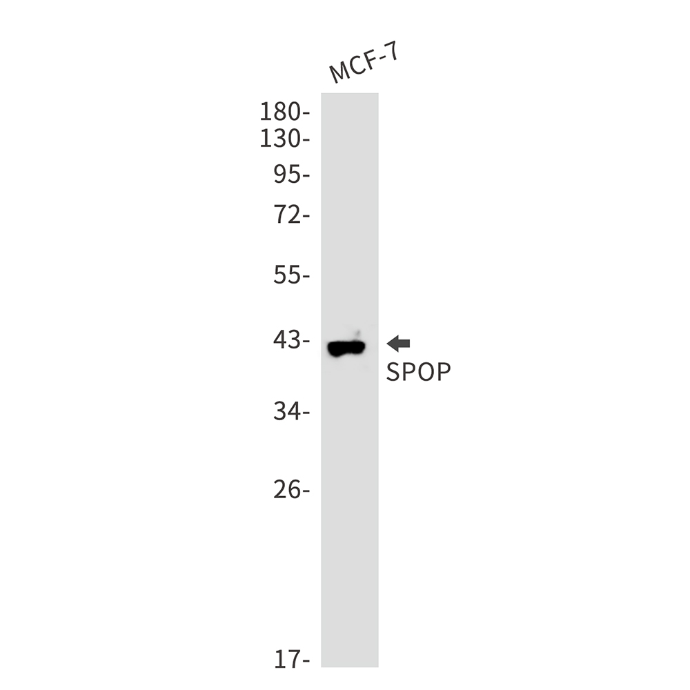 1 - SPOP Rabbit mAb AP76115