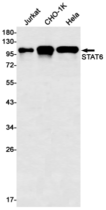 1 - STAT6 Rabbit mAb AP76124