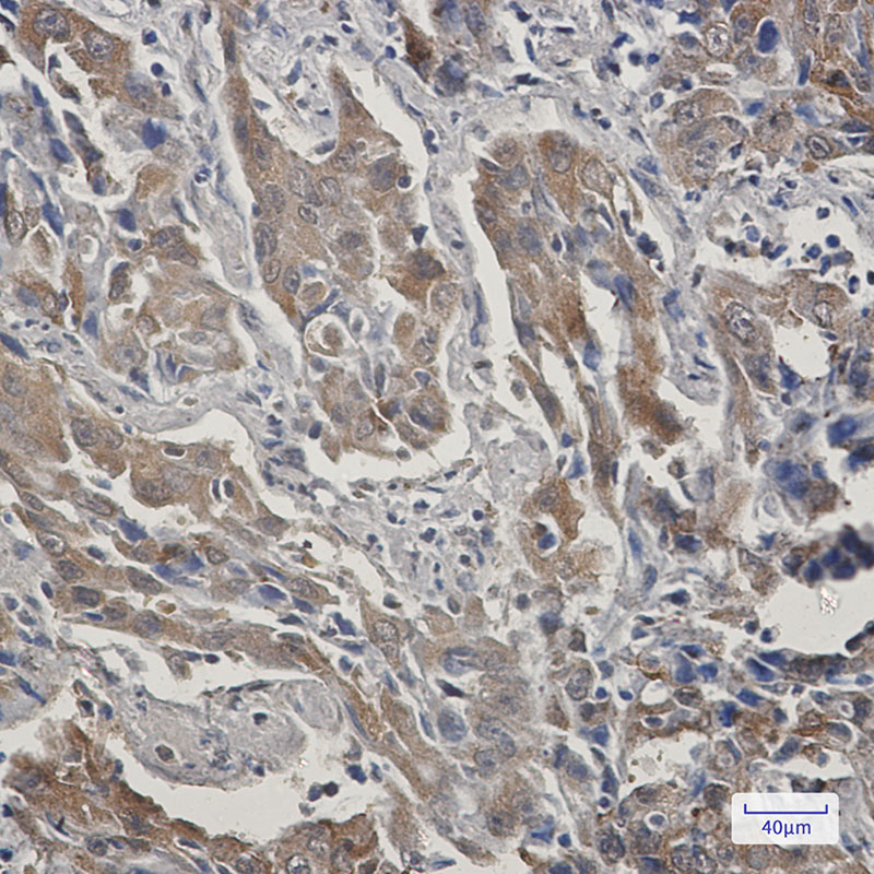 4 - STIP1/STI1 Rabbit mAb AP76126