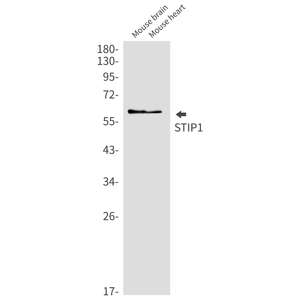 1 - STIP1/STI1 Rabbit mAb AP76126