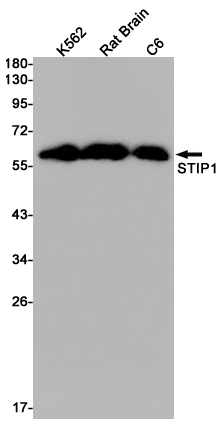 2 - STIP1/STI1 Rabbit mAb AP76126