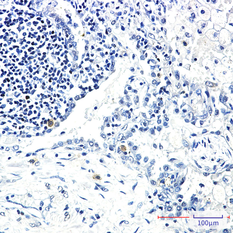 8 - STK3/MST-2 Rabbit mAb AP76127