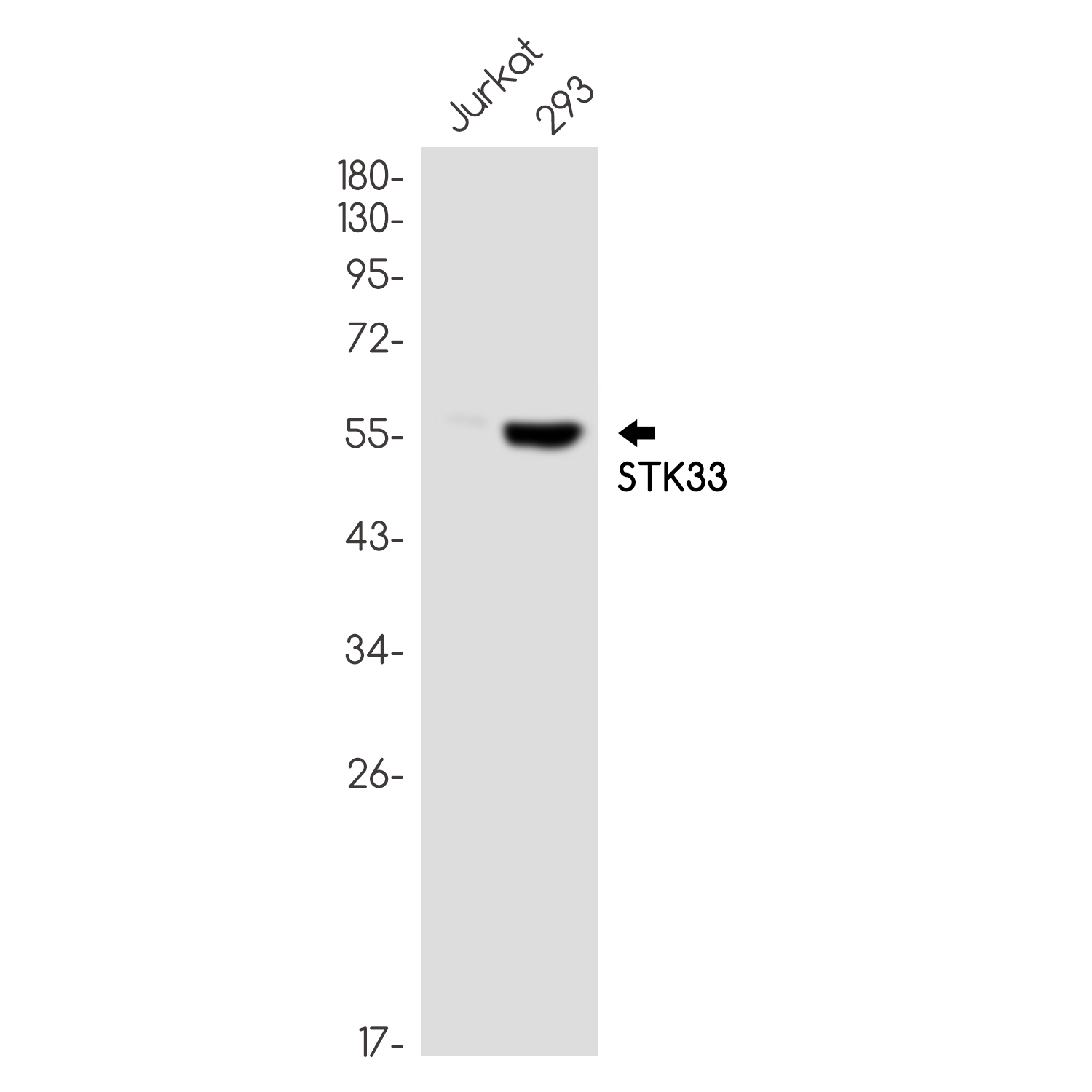 1 - STK33 Rabbit mAb AP76128