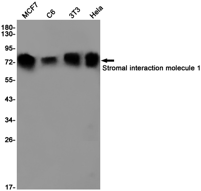1 - Stromal Interaction Molecule 1 Rabbit mAb AP76130