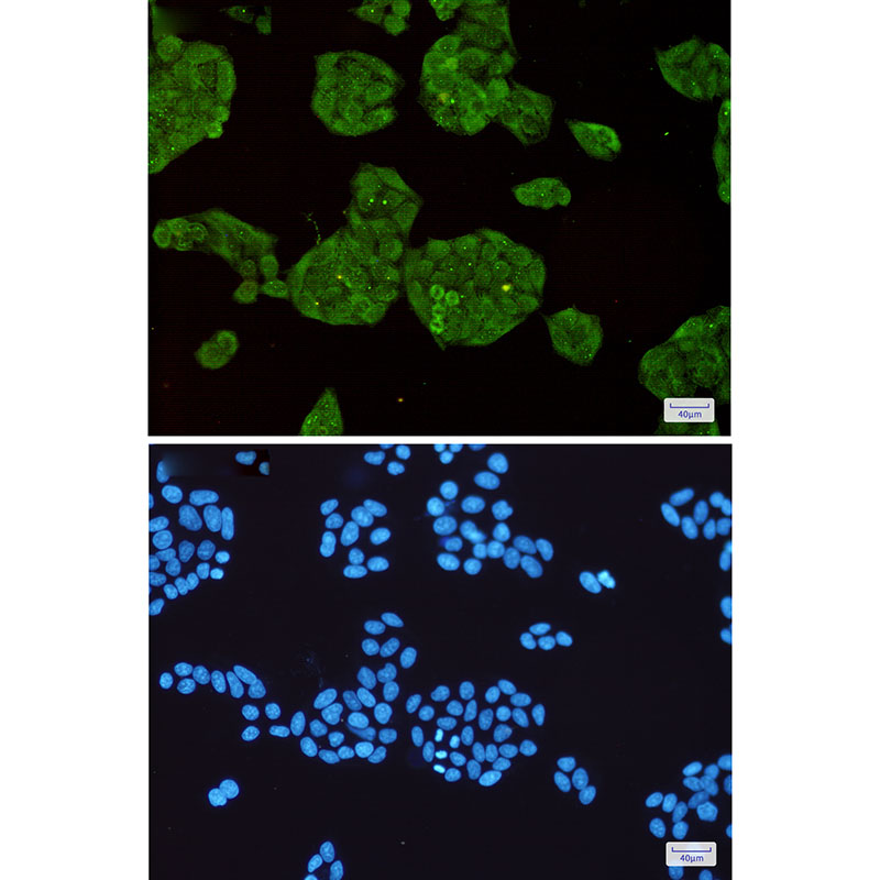 8 - STUB1 Rabbit mAb AP76132